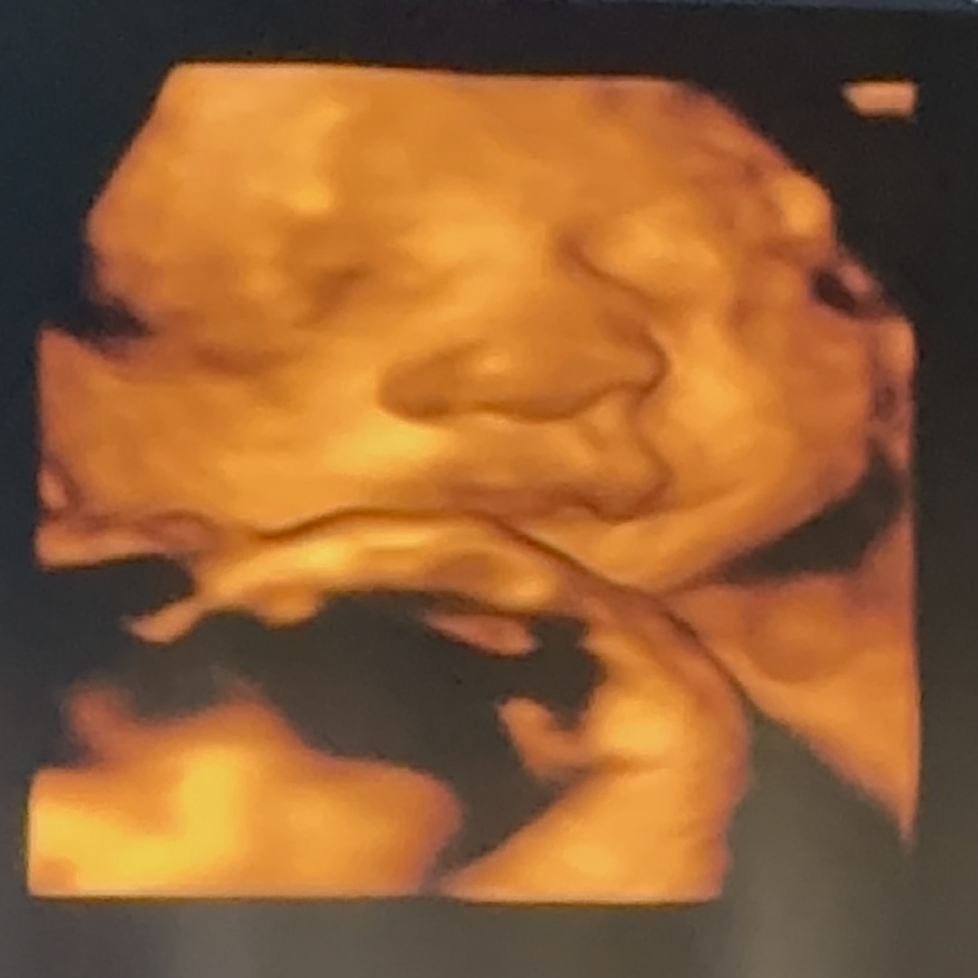 Photo shared by Aliyah for their Babylist baby registry.