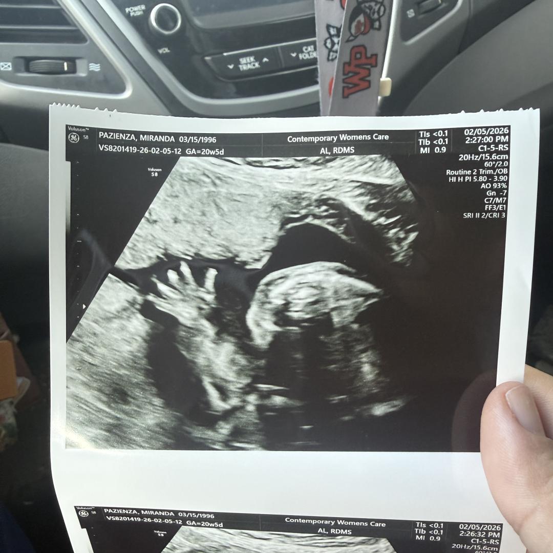Photo shared by Miranda for their Babylist baby registry.