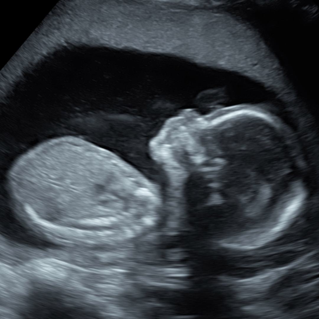 Photo shared by Olivia for their Babylist baby registry.