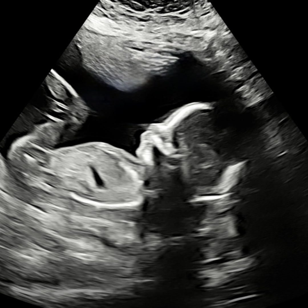 Photo shared by Trevor & Christen for their Babylist baby registry.