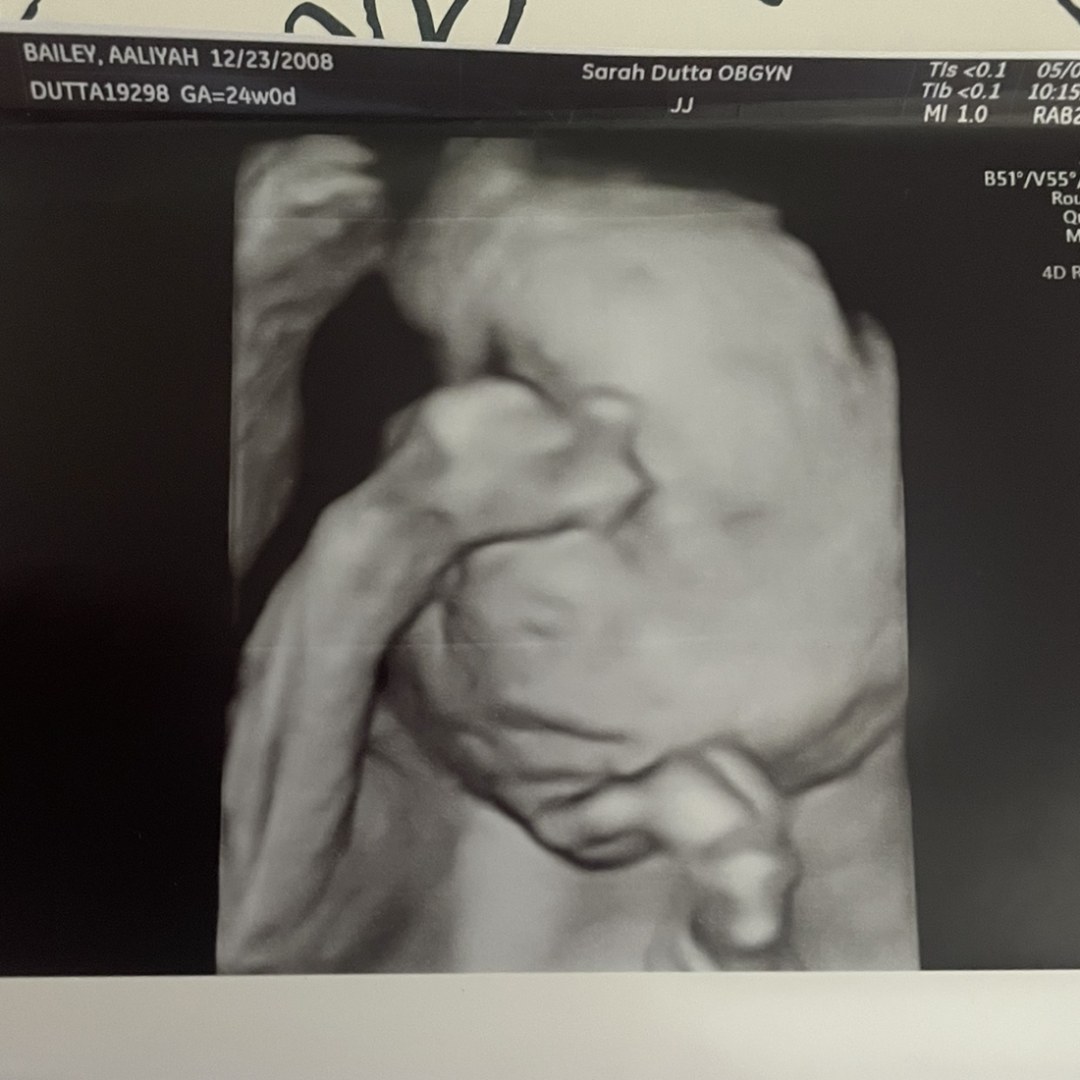 Photo shared by Aaliyah for their Babylist baby registry.