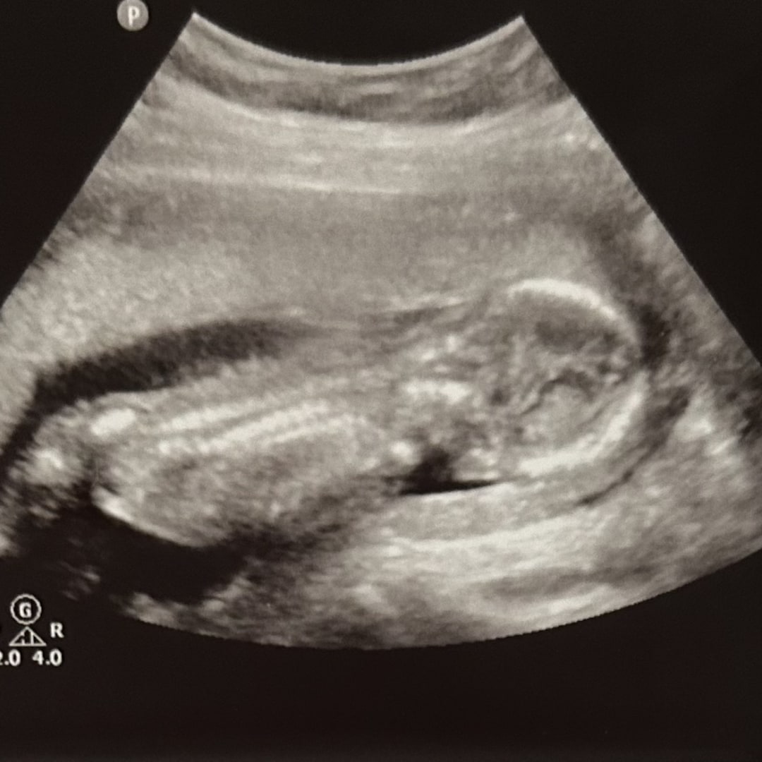 Photo shared by Annie for their Babylist baby registry.