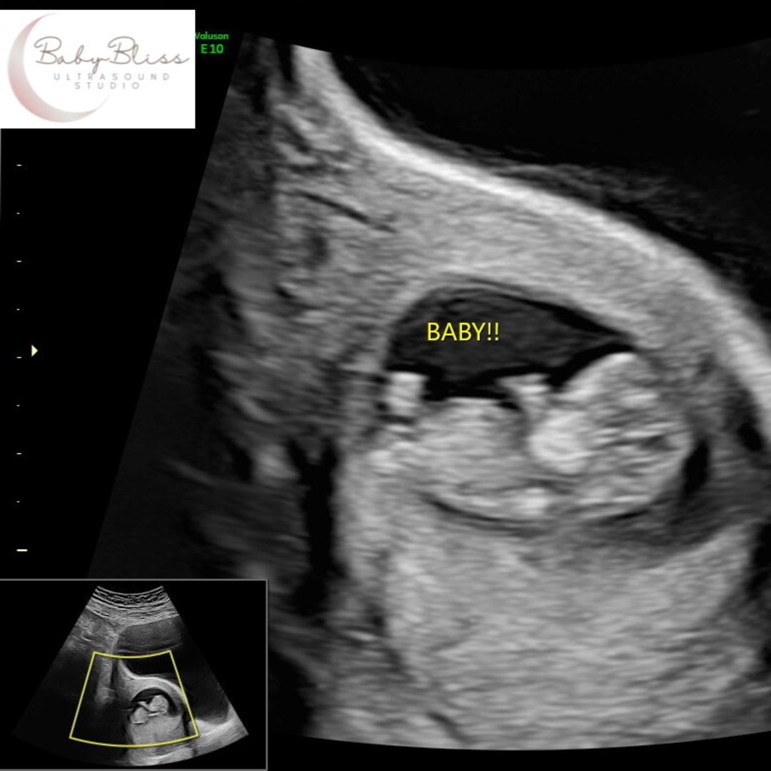 Photo shared by Kylee for their Babylist baby registry.