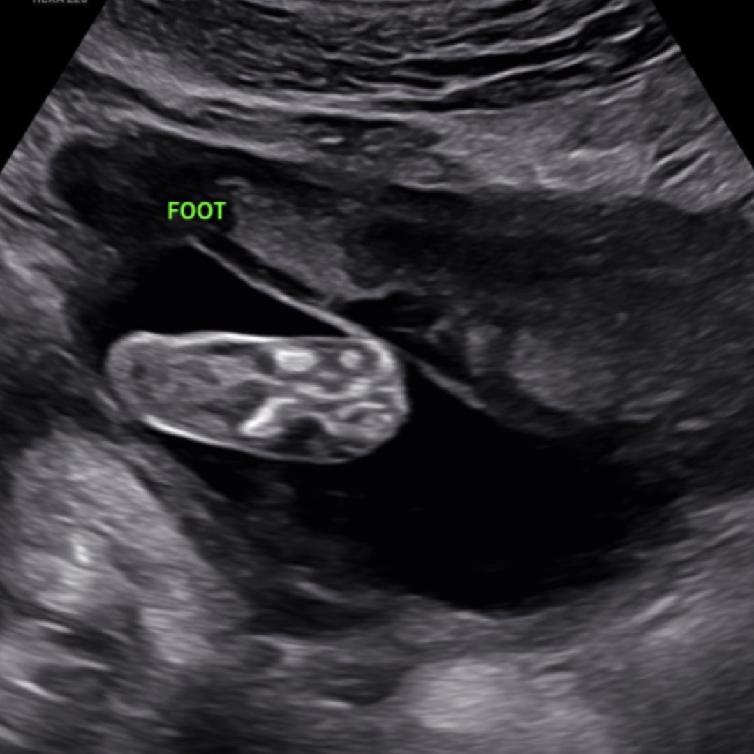 Photo shared by Donata for their Babylist baby registry.