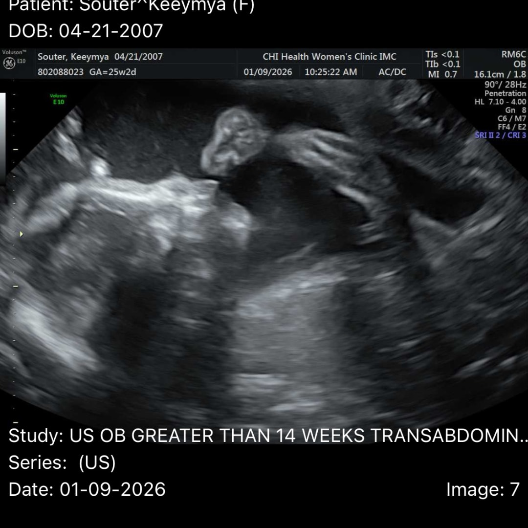 Photo shared by Keeymya for their Babylist baby registry.