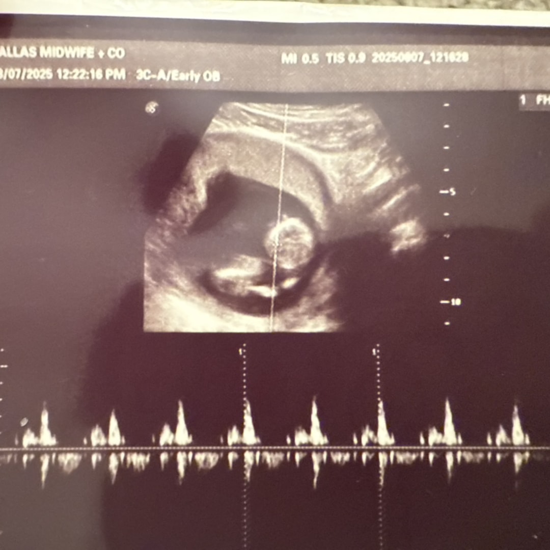 Photo shared by Sarah Joy for their Babylist baby registry.