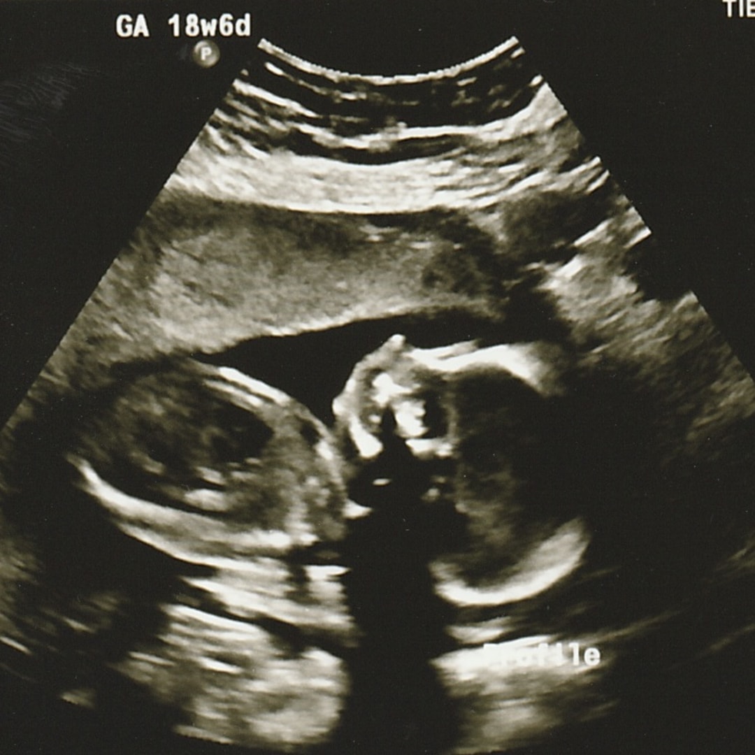 Photo shared by Ashlynne for their Babylist baby registry.