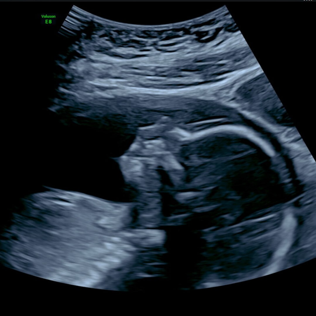 Photo shared by Holly for their Babylist baby registry.