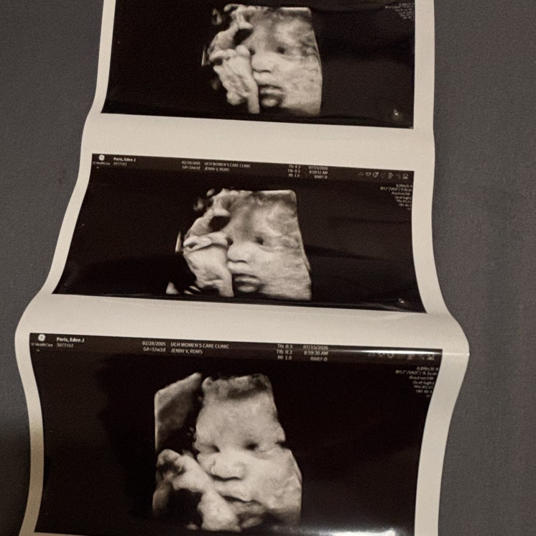 Photo shared by Eden for their Babylist baby registry.