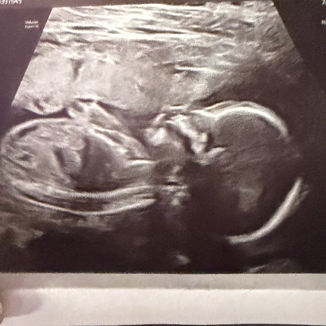 Photo shared by Sarah for their Babylist baby registry.