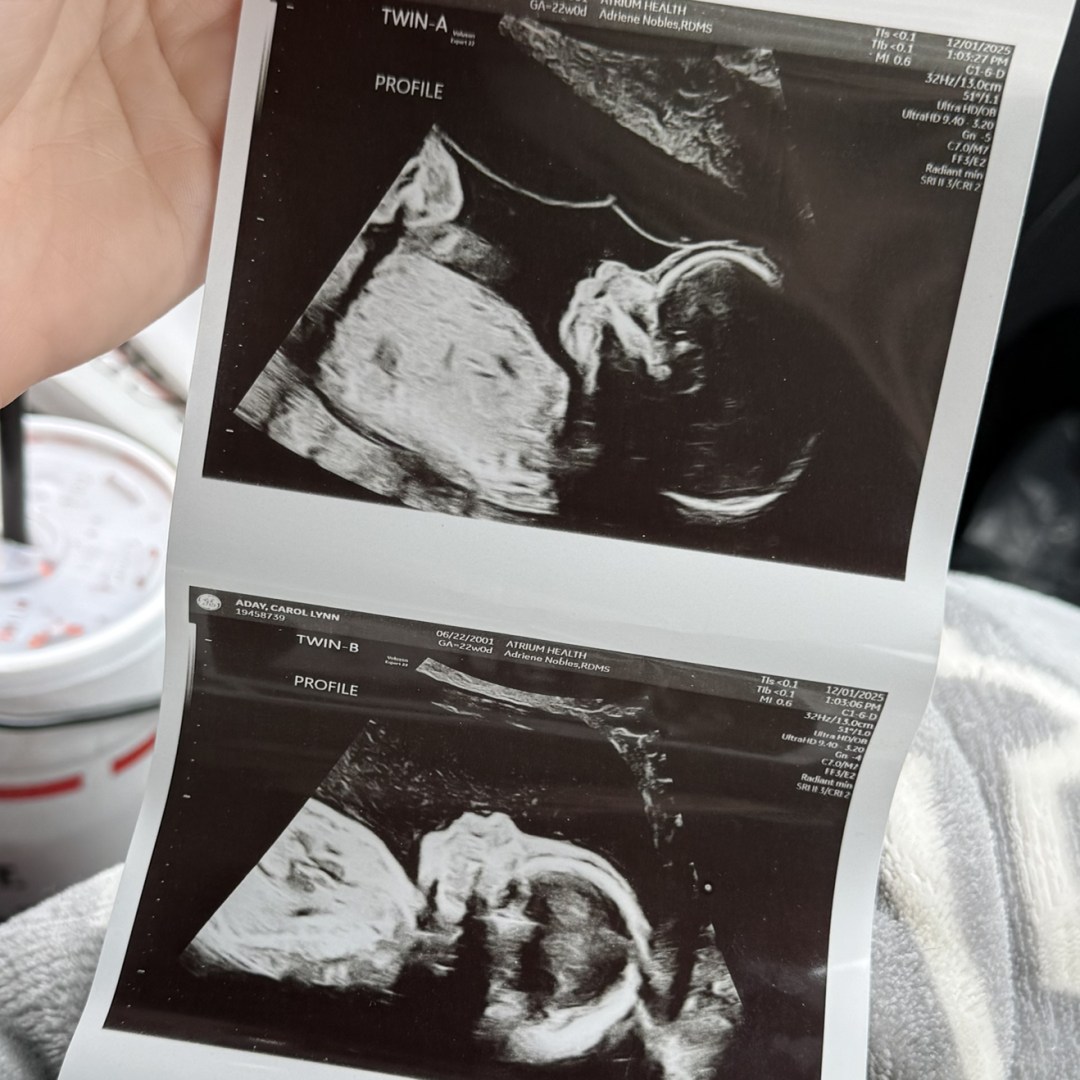 Photo shared by Carol for their Babylist baby registry.