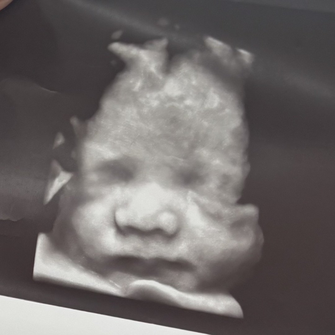 Photo shared by Samantha for their Babylist baby registry.