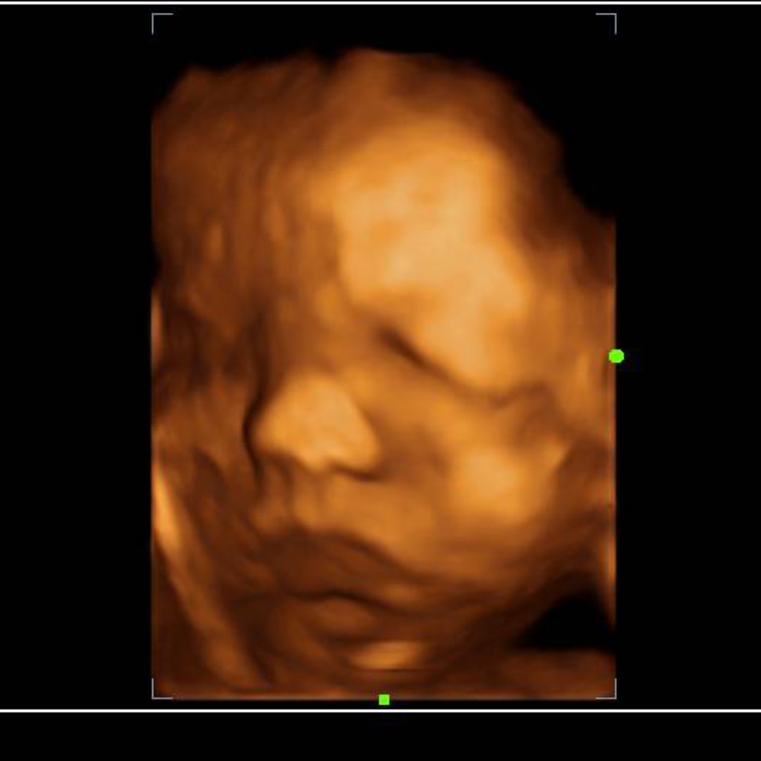 Photo shared by Armina for their Babylist baby registry.