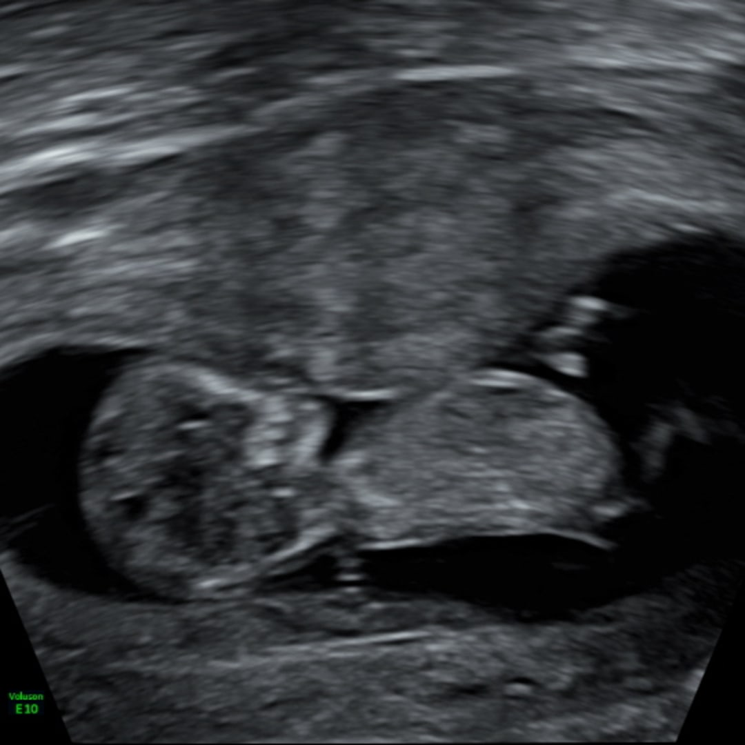 Photo shared by Grace for their Babylist baby registry.