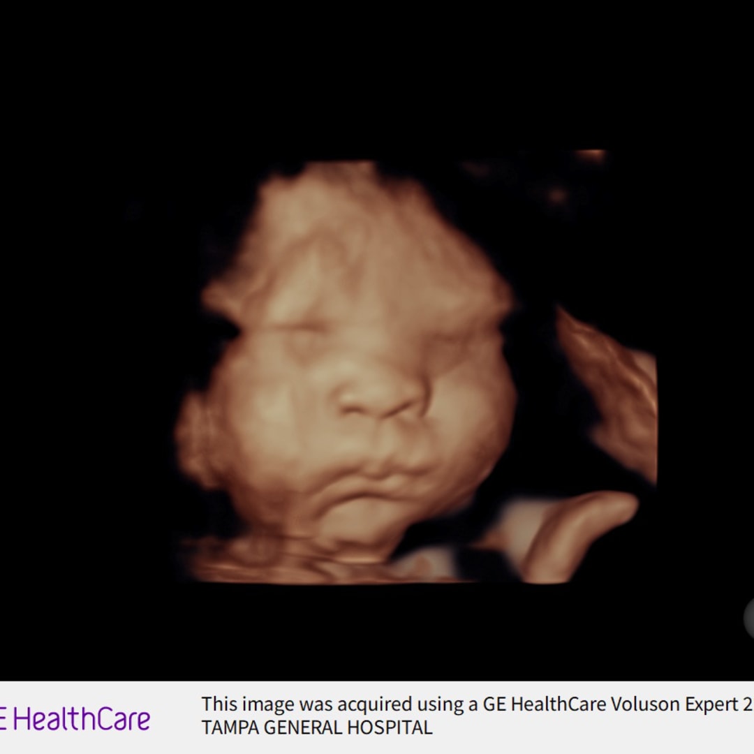 Photo shared by Sarah for their Babylist baby registry.