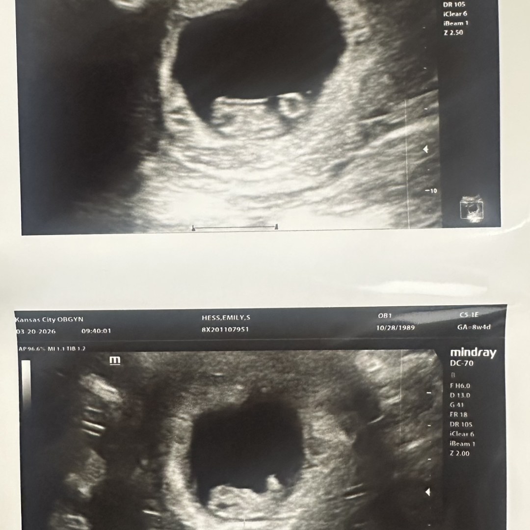Photo shared by Emily for their Babylist baby registry.