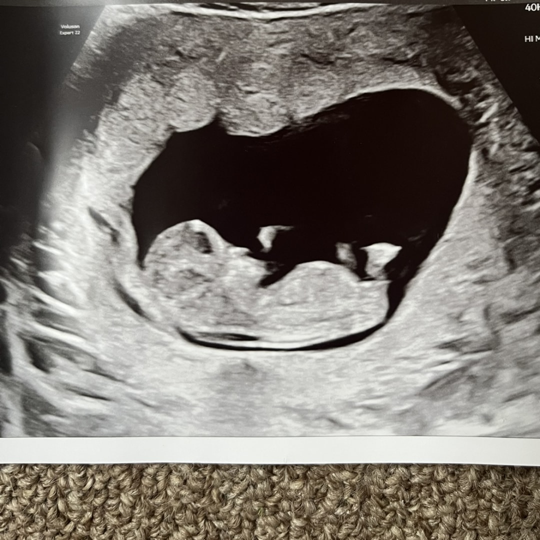 Photo shared by Ashley for their Babylist baby registry.