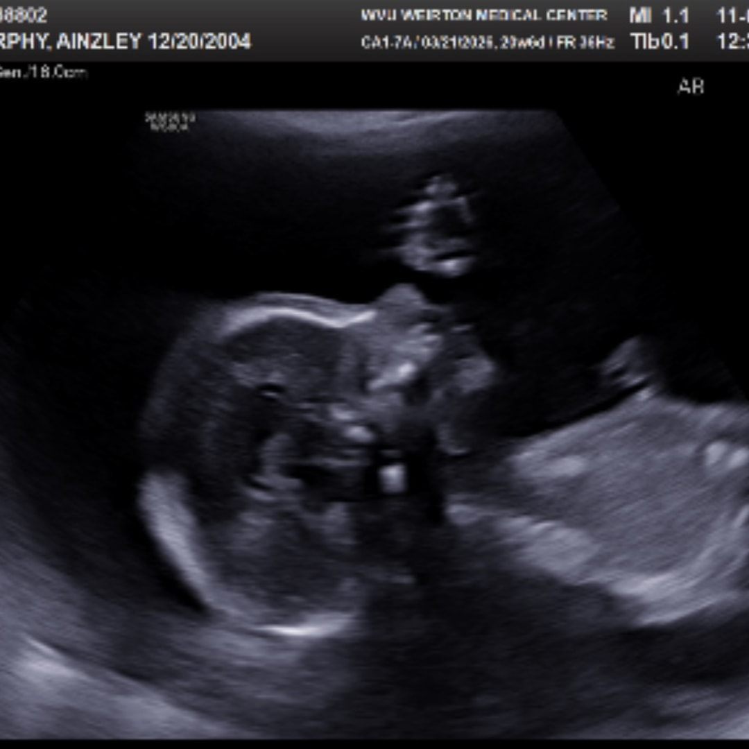 Photo shared by Ainzley for their Babylist baby registry.