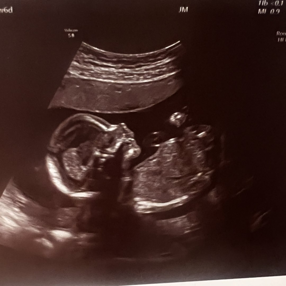 Photo shared by Amanda for their Babylist baby registry.