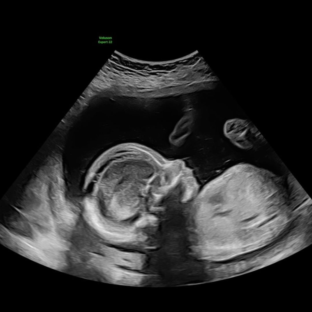 Photo shared by Anabella for their Babylist baby registry.