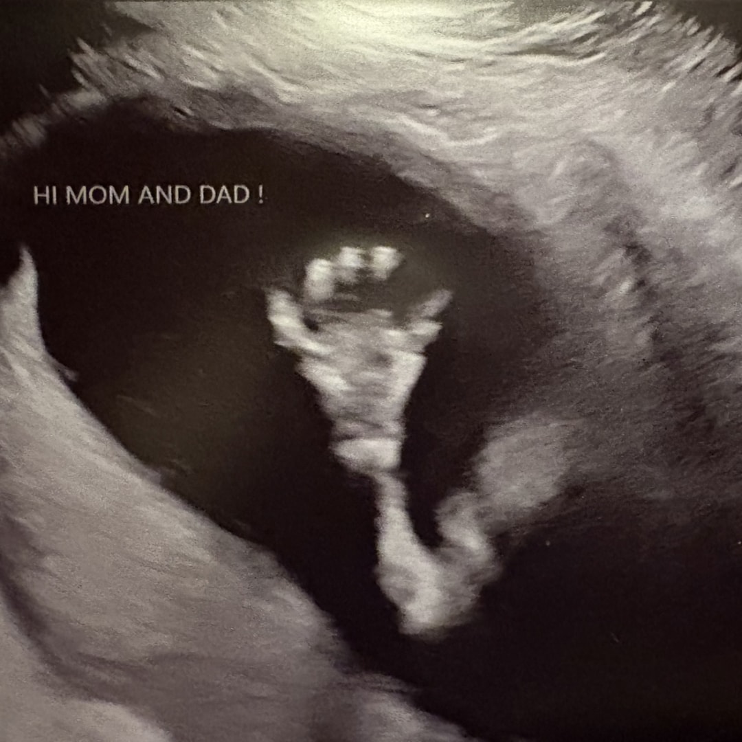 Photo shared by Lindsey for their Babylist baby registry.