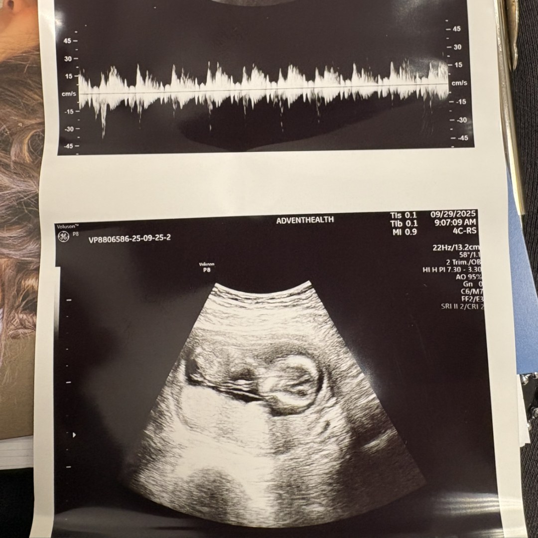 Photo shared by Mia for their Babylist baby registry.