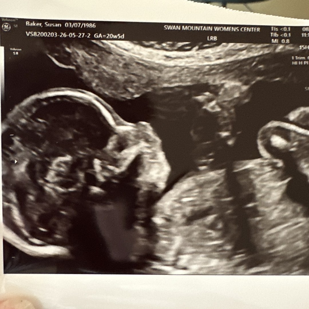 Photo shared by Susan for their Babylist baby registry.