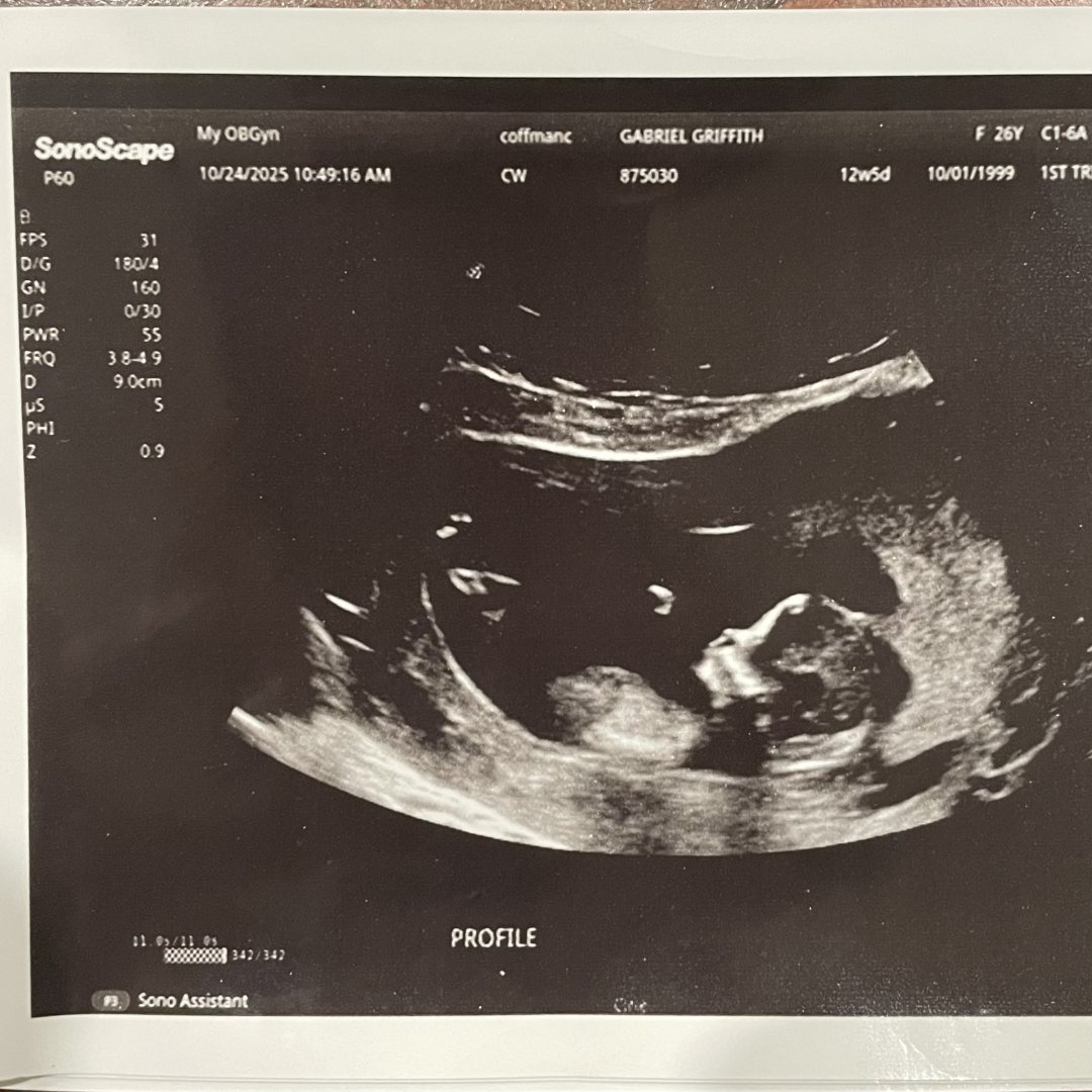 Photo shared by Gigi for their Babylist baby registry.