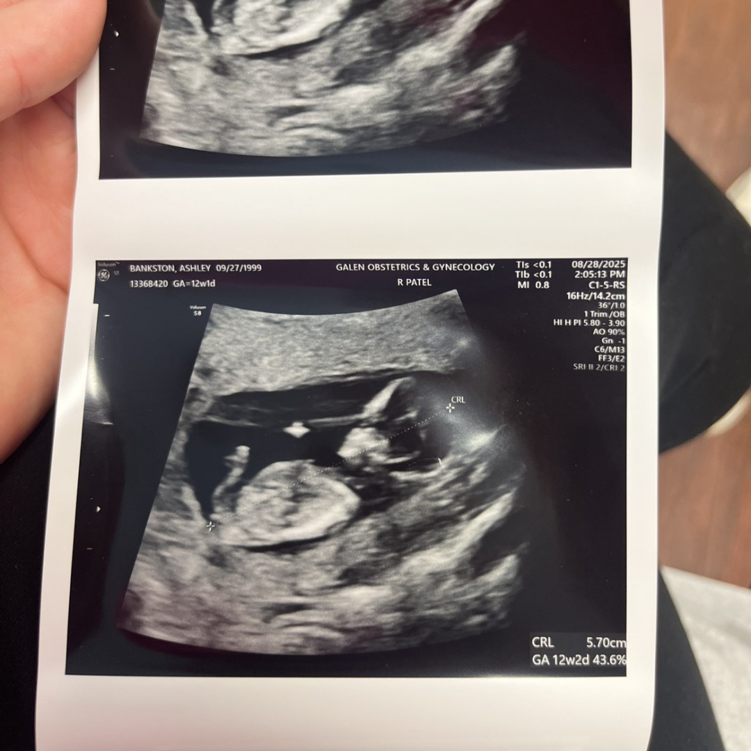Photo shared by Ashley for their Babylist baby registry.