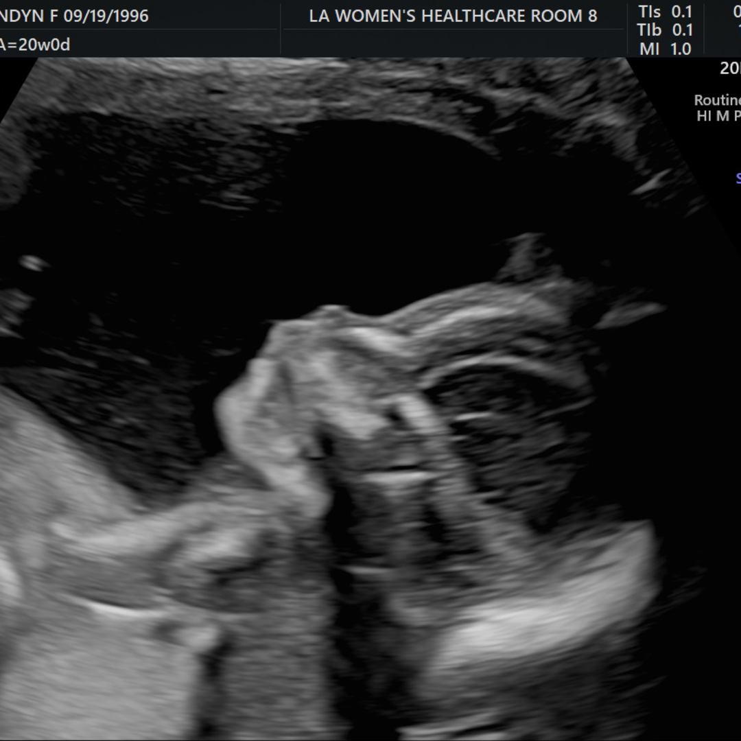 Photo shared by Londyn for their Babylist baby registry.