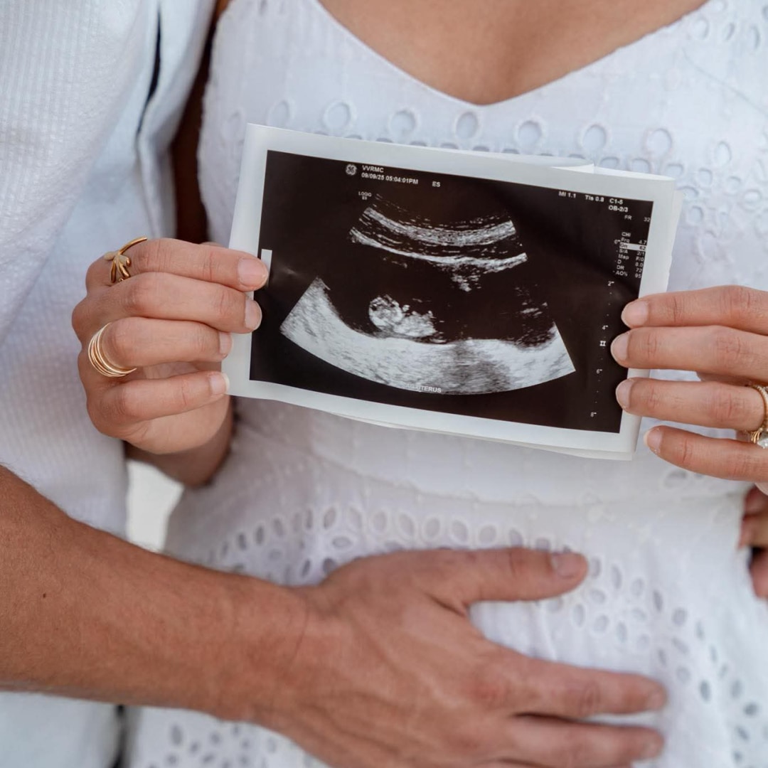 Photo shared by Abi for their Babylist baby registry.