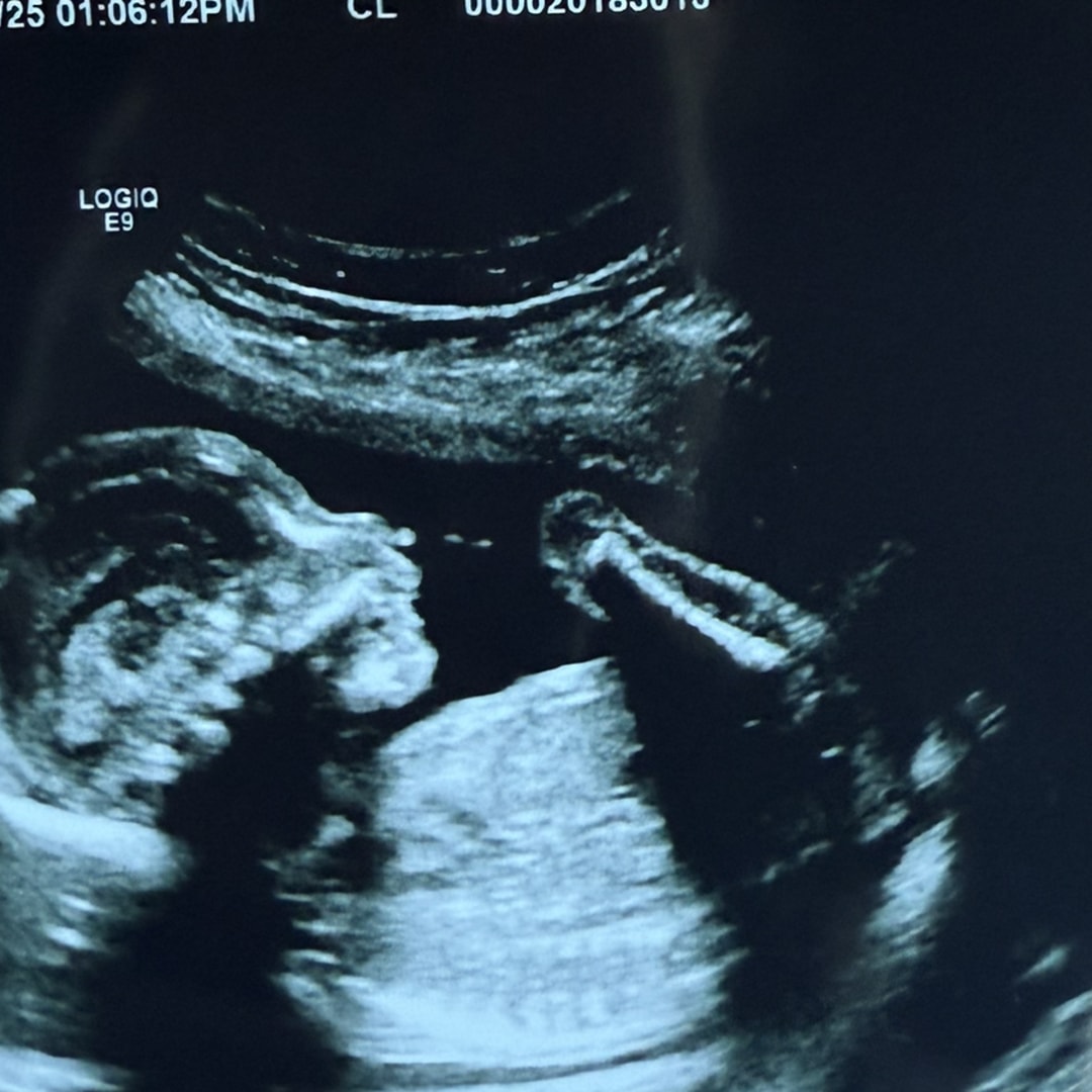 Photo shared by Jocelyn for their Babylist baby registry.