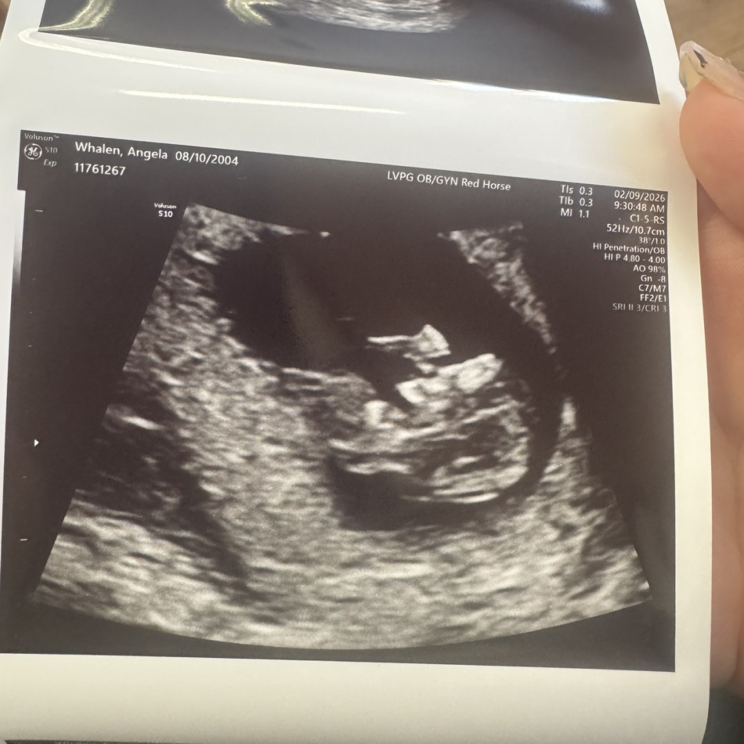 Photo shared by Angela for their Babylist baby registry.