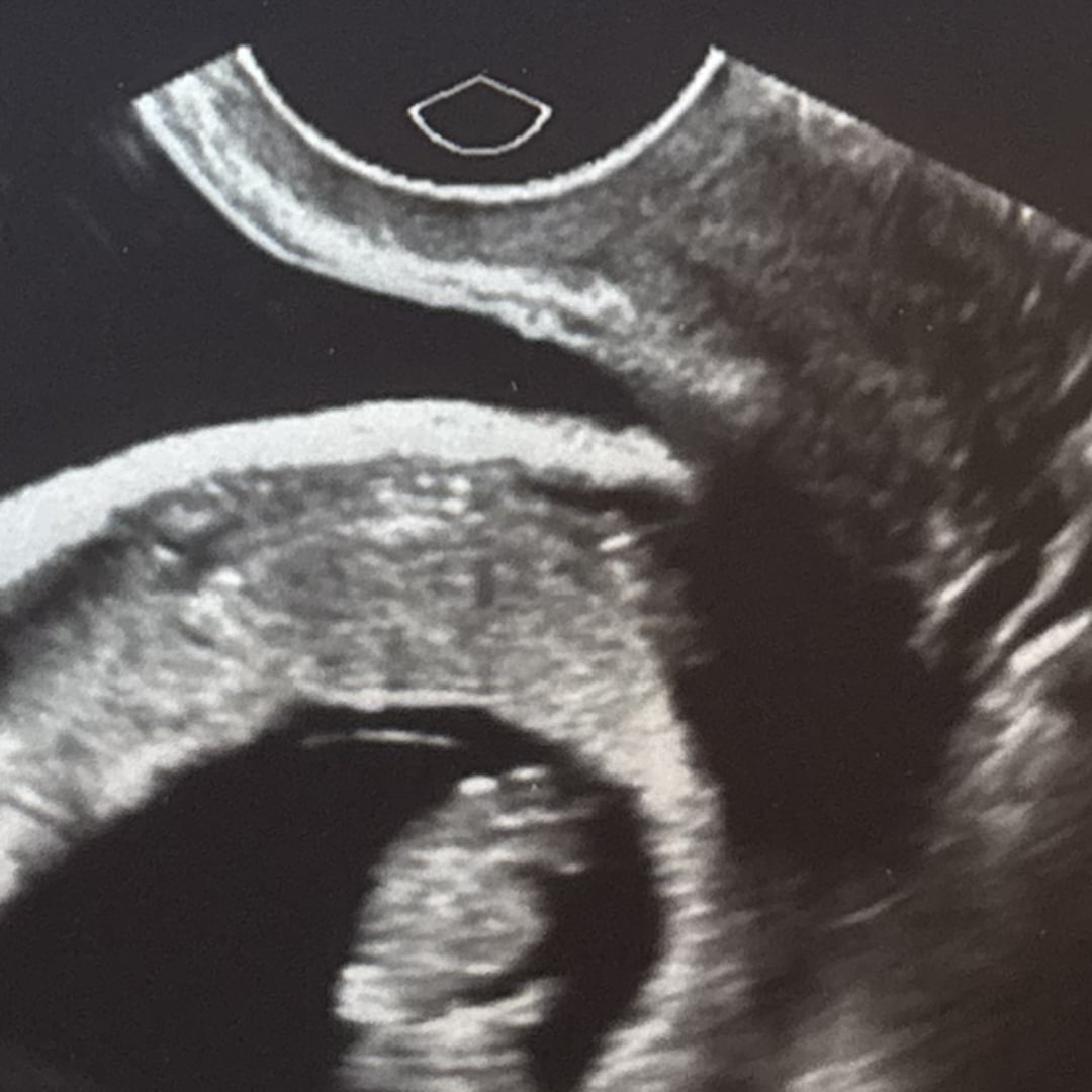 Photo shared by Lexi for their Babylist baby registry.