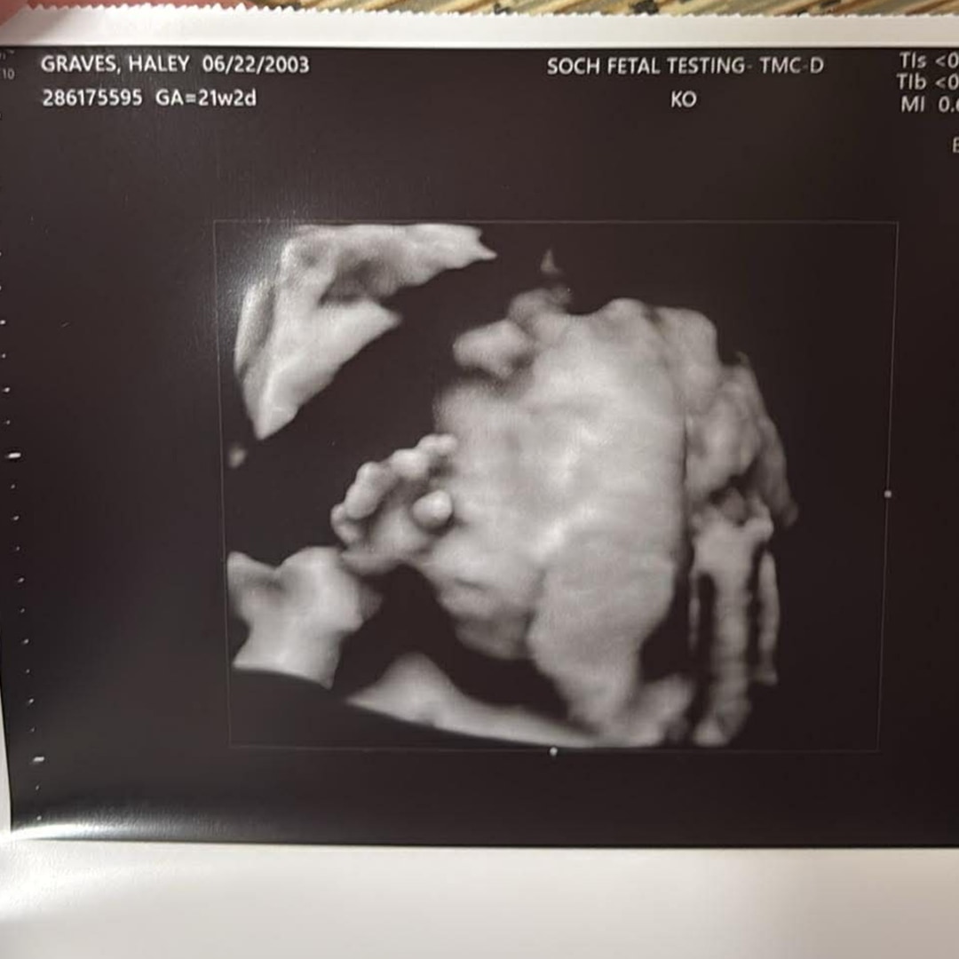 Photo shared by Haley for their Babylist baby registry.
