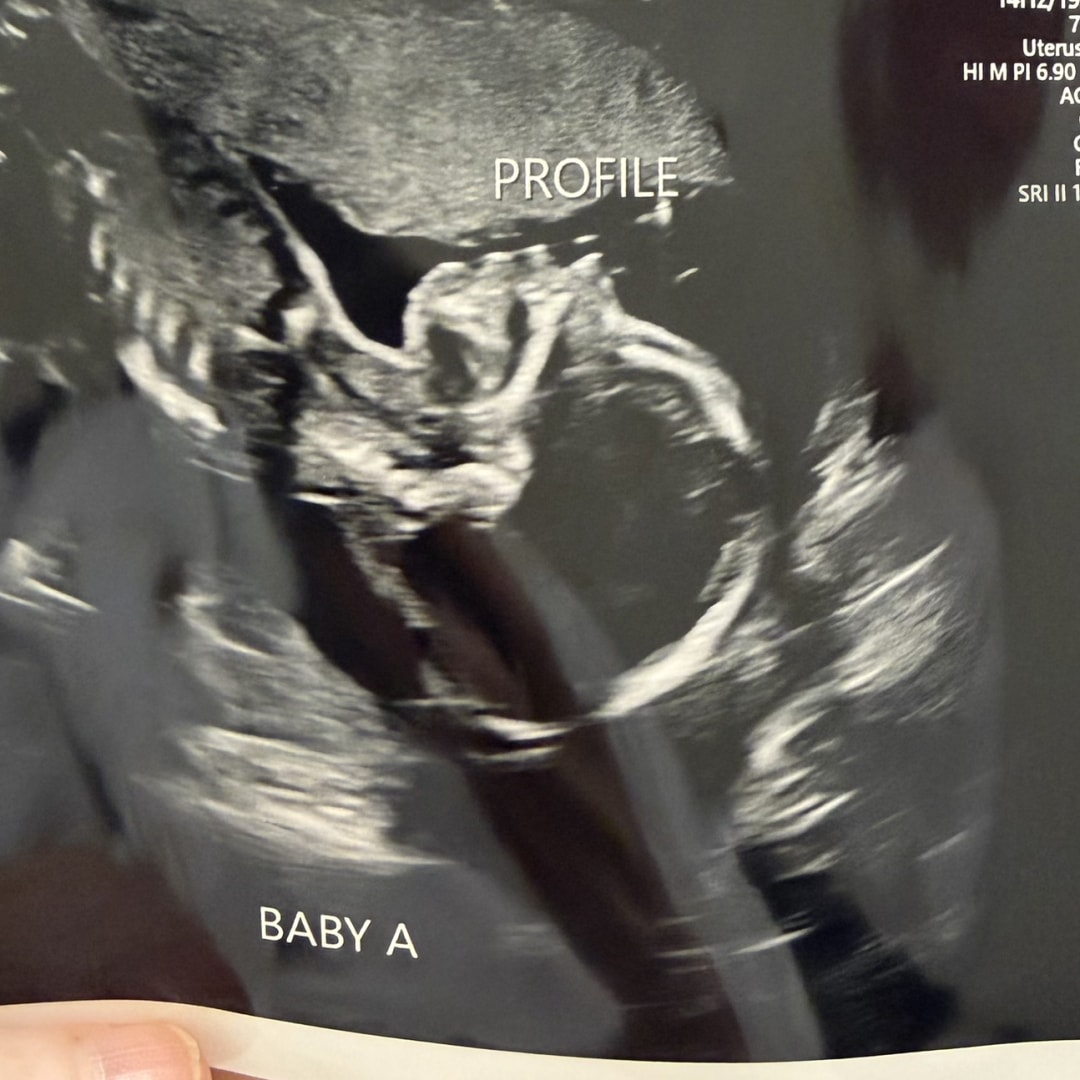 Photo shared by Haley for their Babylist baby registry.