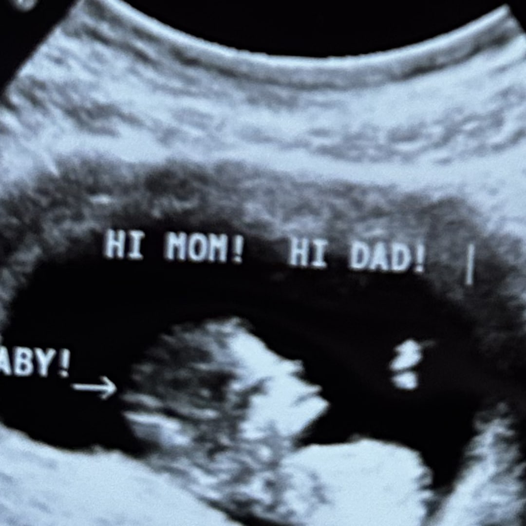 Photo shared by Naomi for their Babylist baby registry.