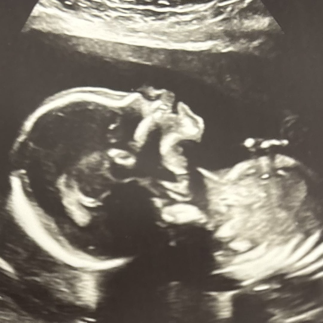 Photo shared by Linda for their Babylist baby registry.