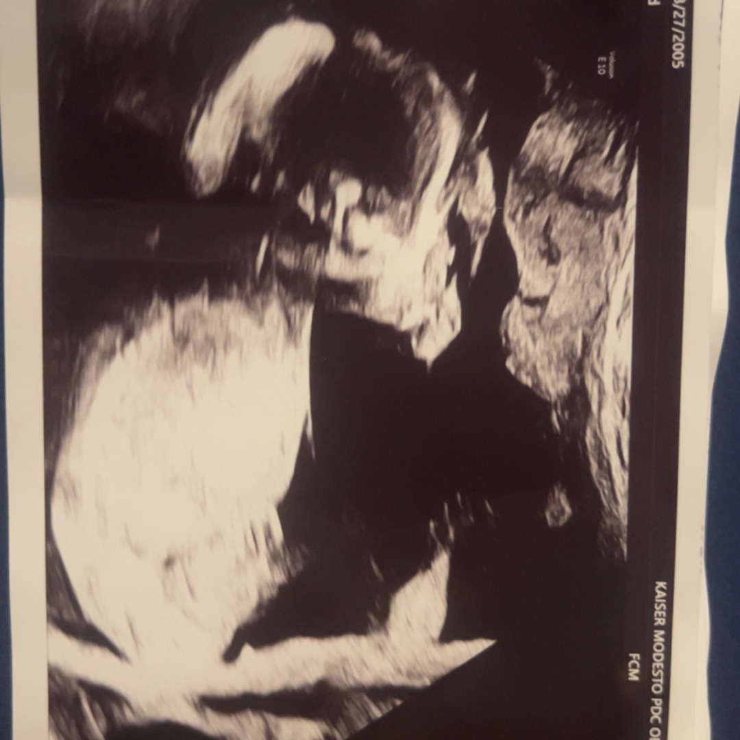 Photo shared by Kaylee for their Babylist baby registry.