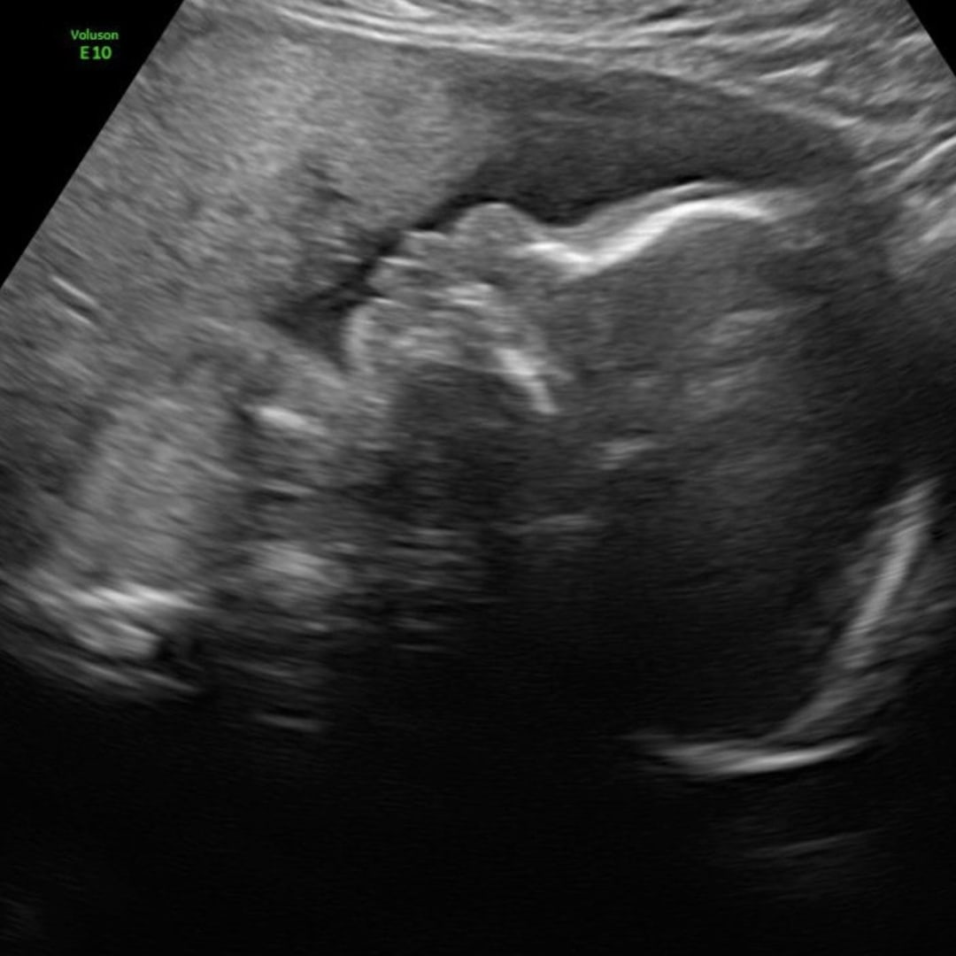 Photo shared by Lauren for their Babylist baby registry.