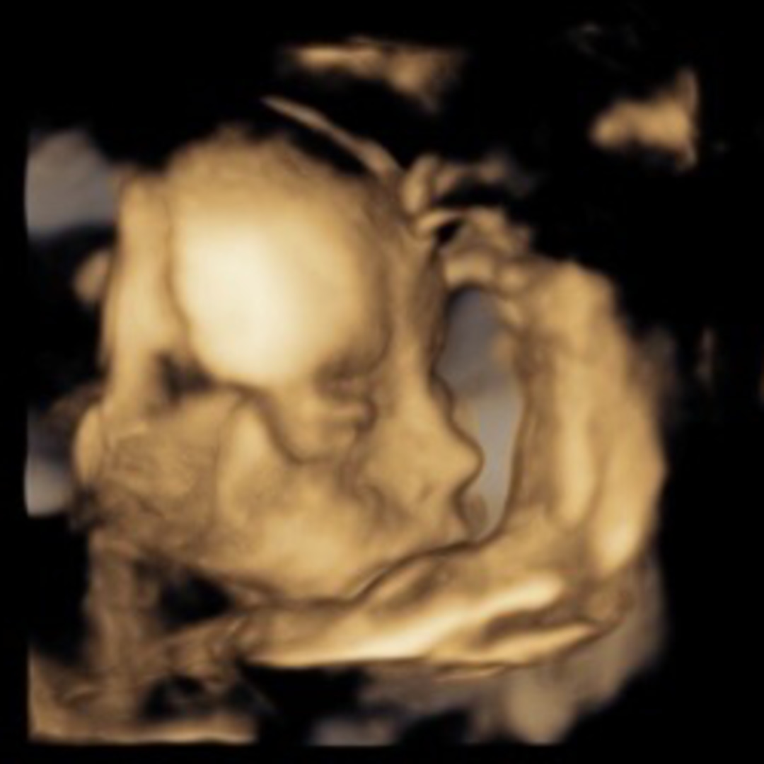 Photo shared by Rebecca for their Babylist baby registry.