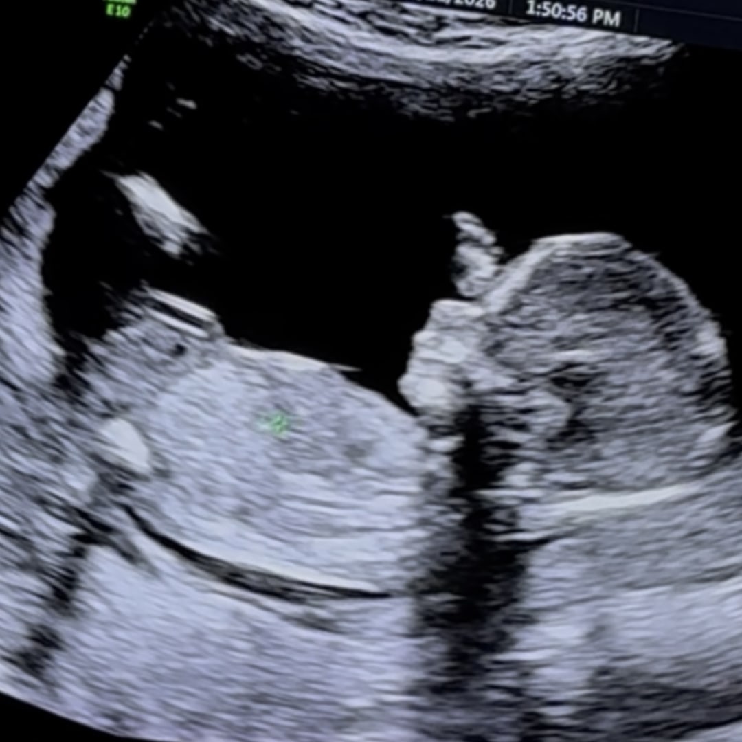 Photo shared by Melanie for their Babylist baby registry.