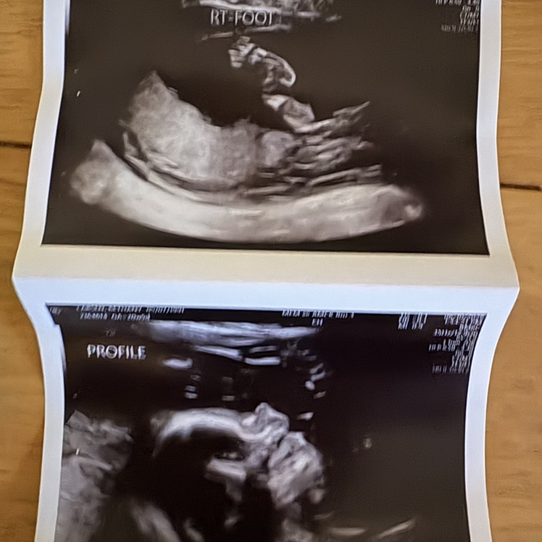 Photo shared by Bethany for their Babylist baby registry.