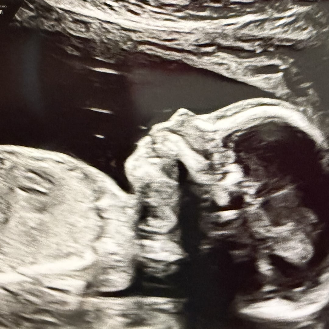 Photo shared by Allison for their Babylist baby registry.