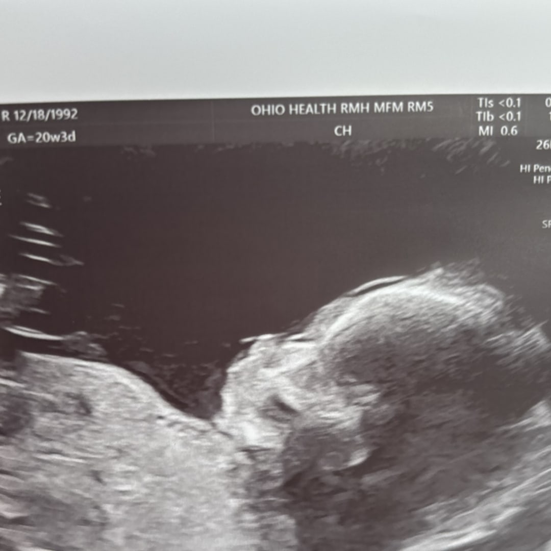 Photo shared by Kaci for their Babylist baby registry.