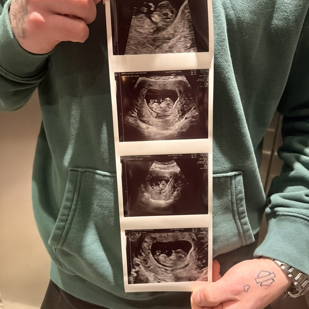 Photo shared by Elizabeth for their Babylist baby registry.