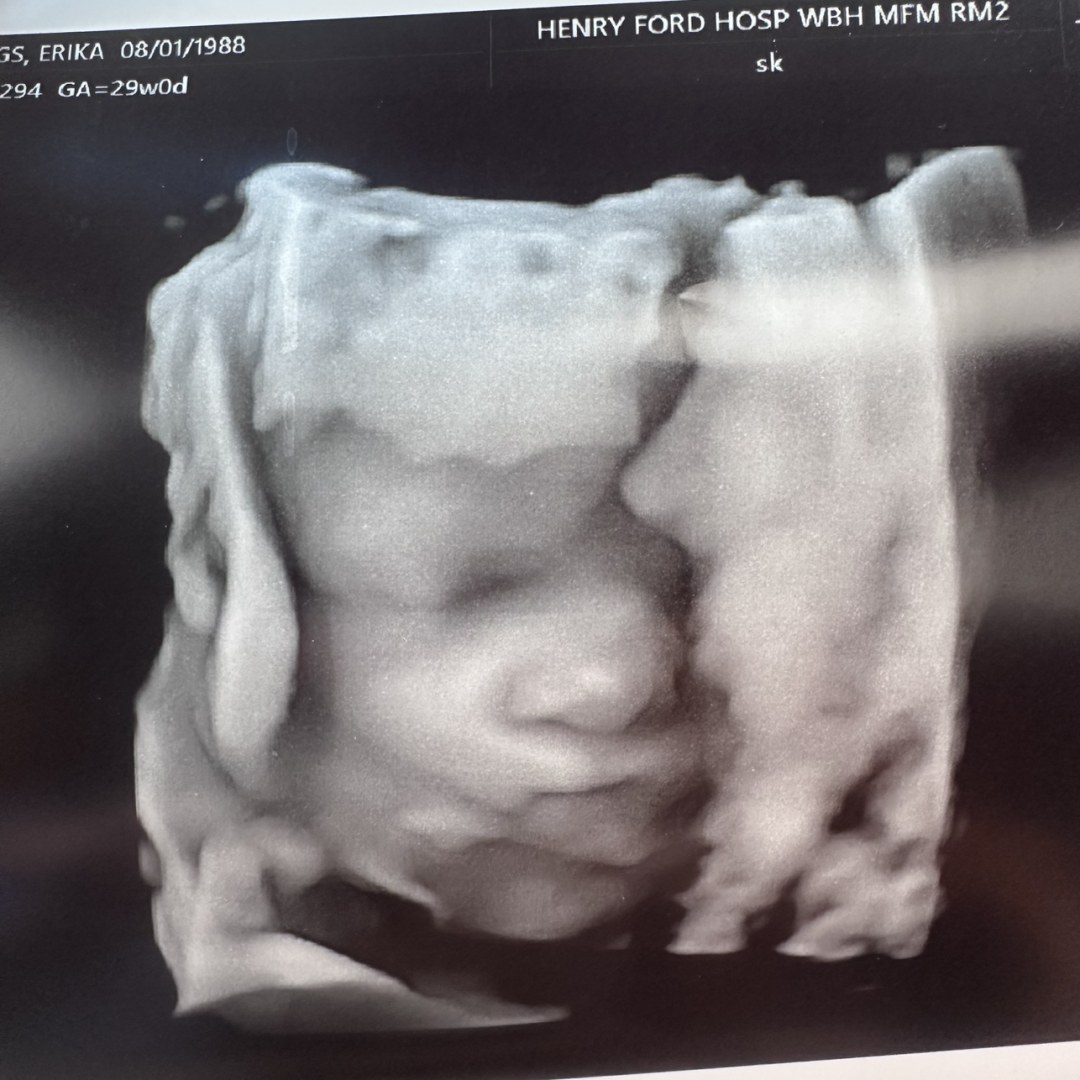 Photo shared by Erika for their Babylist baby registry.