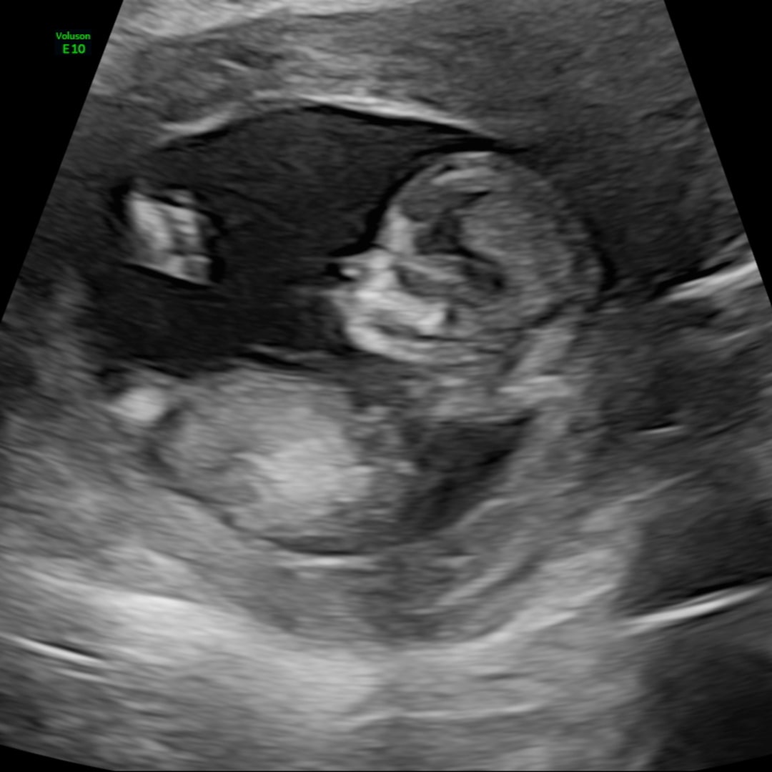 Photo shared by Jaimie for their Babylist baby registry.