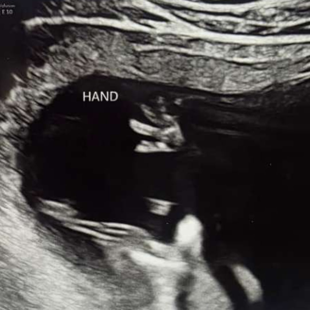 Photo shared by Cambrie for their Babylist baby registry.