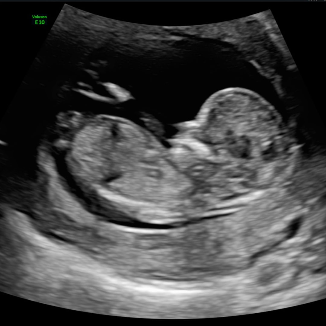 Photo shared by Emma for their Babylist baby registry.